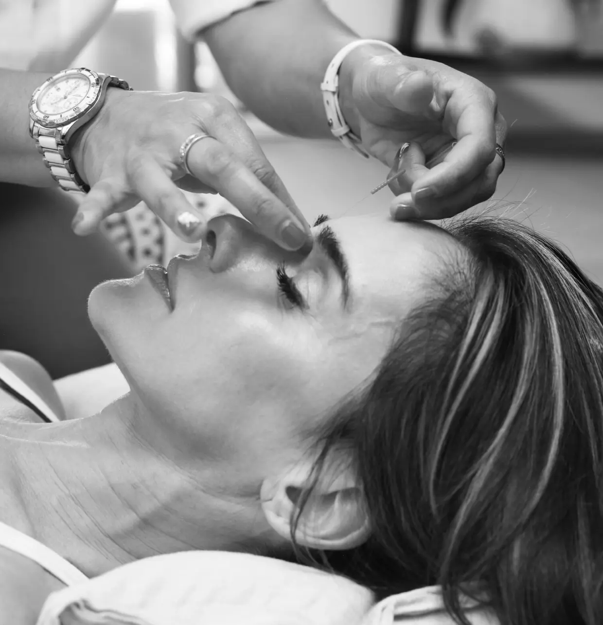 Acupuncture-about-5