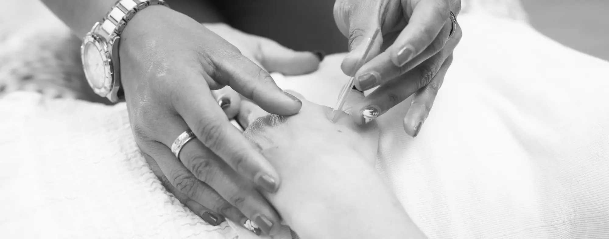 Acupuncture-services-header