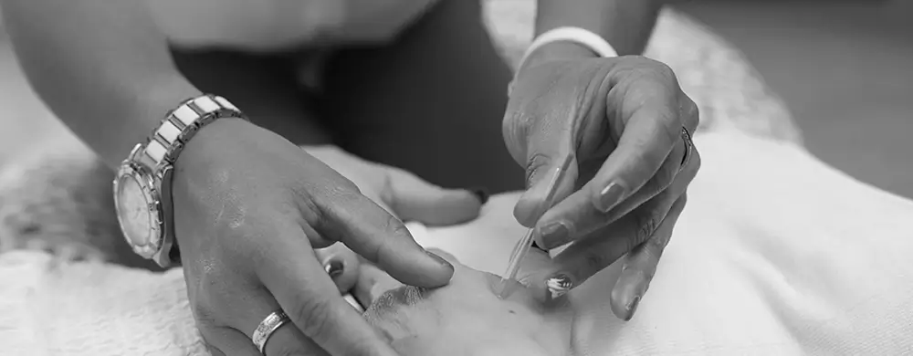 acupuncture-1-10-1711547576-1049643156