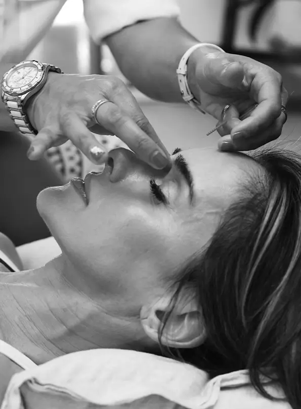 acupuncture-1-3-1711547565-1738415888